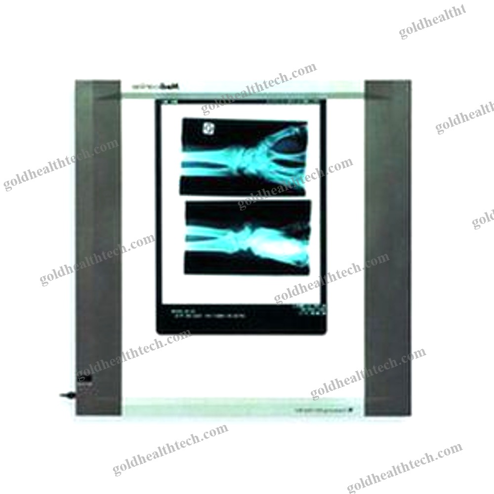 1-Screen X-Ray Film Viewer