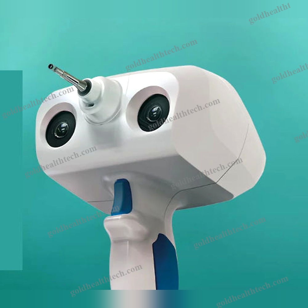 Abr Screening System