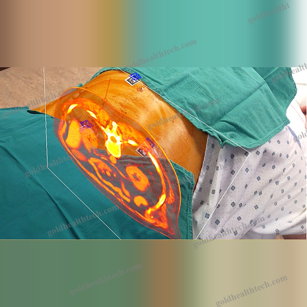 Ar Surgical Navigation System