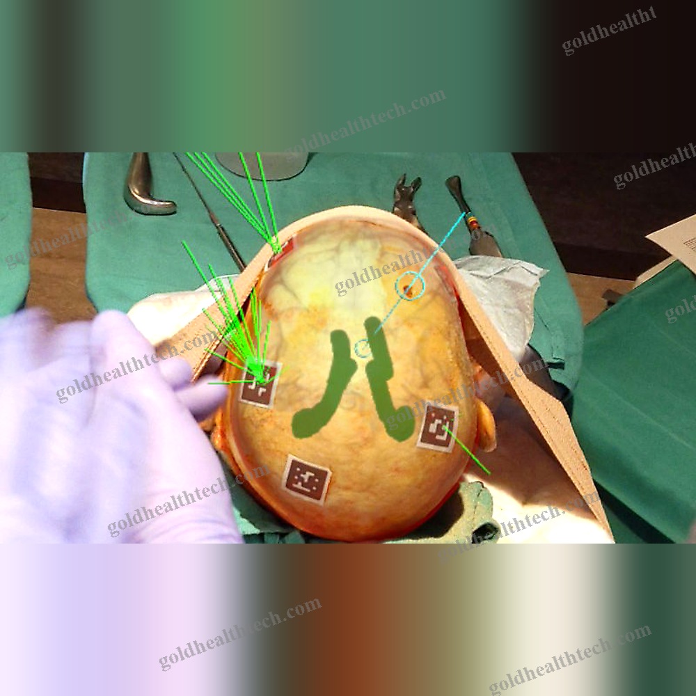 Ar Surgical Navigation System