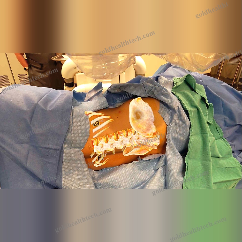 Ar Surgical Navigation System