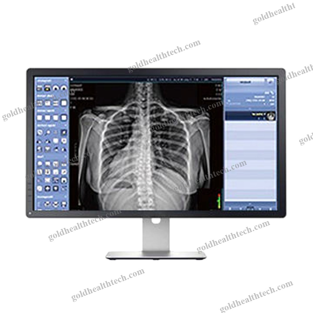 Medical Imaging Pacs