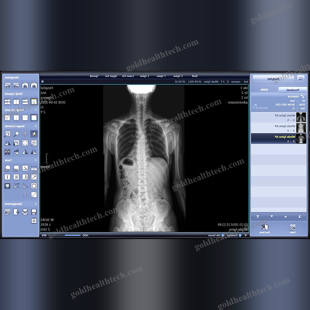 Medical Imaging Pacs