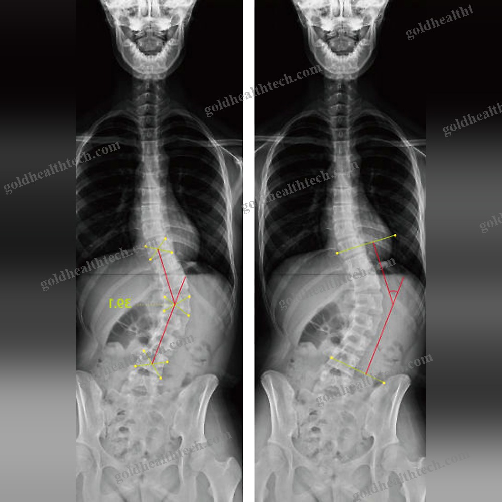 Medical Imaging Pacs