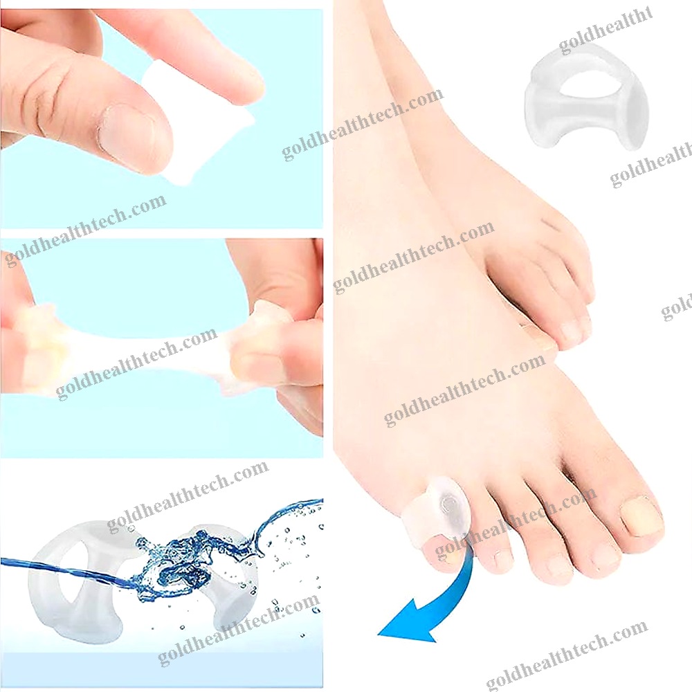 Toe Separator