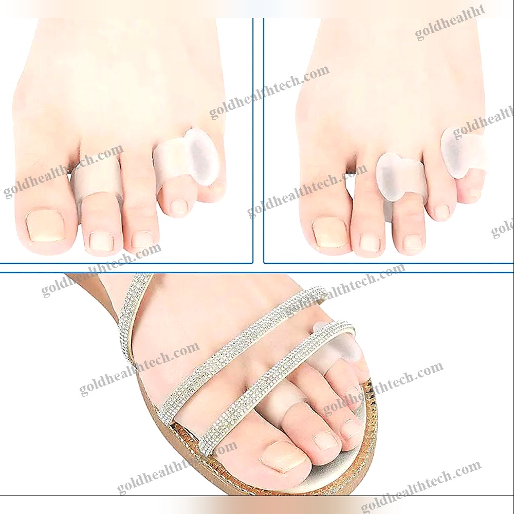 Toe Separator