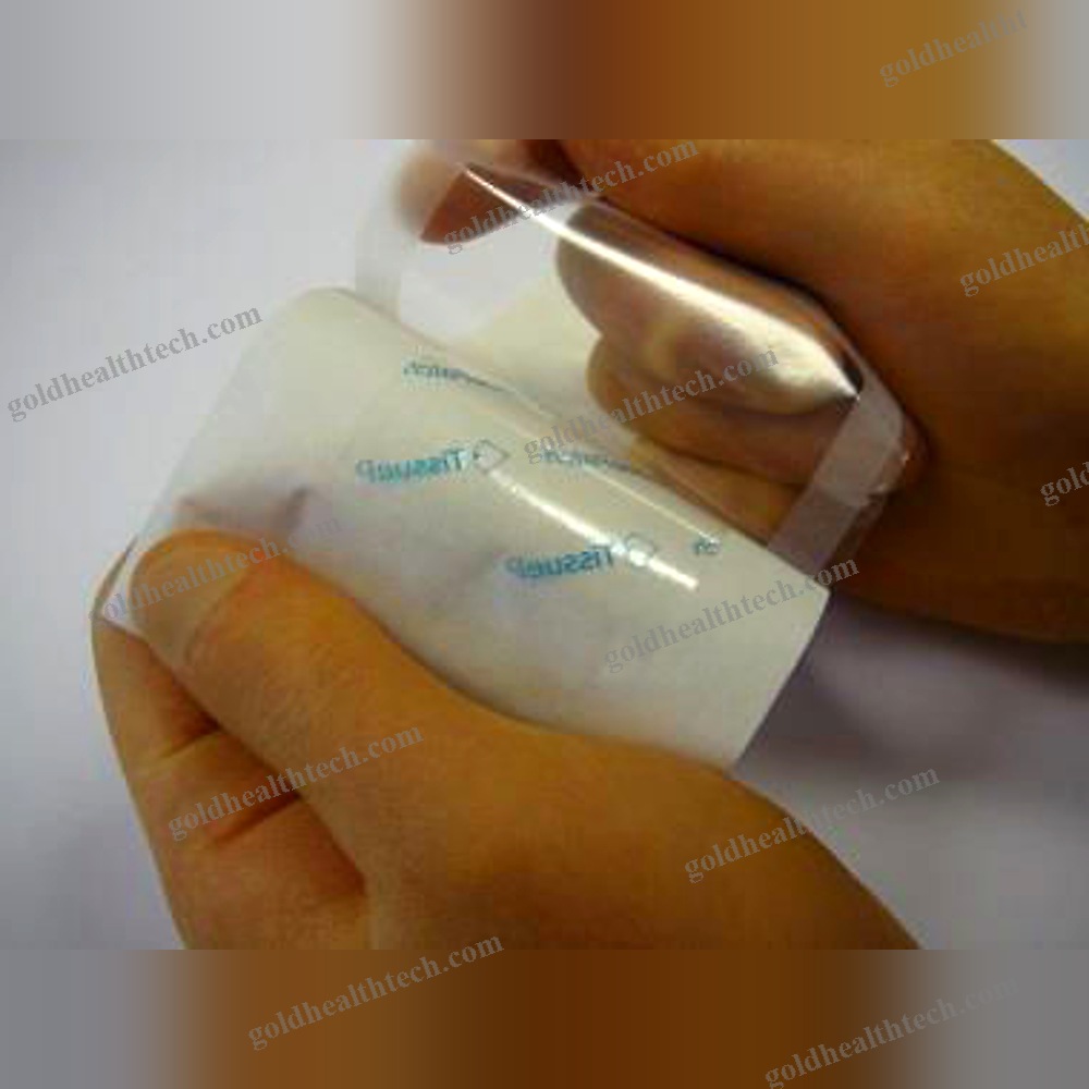 Thoracic Tissue Matrix