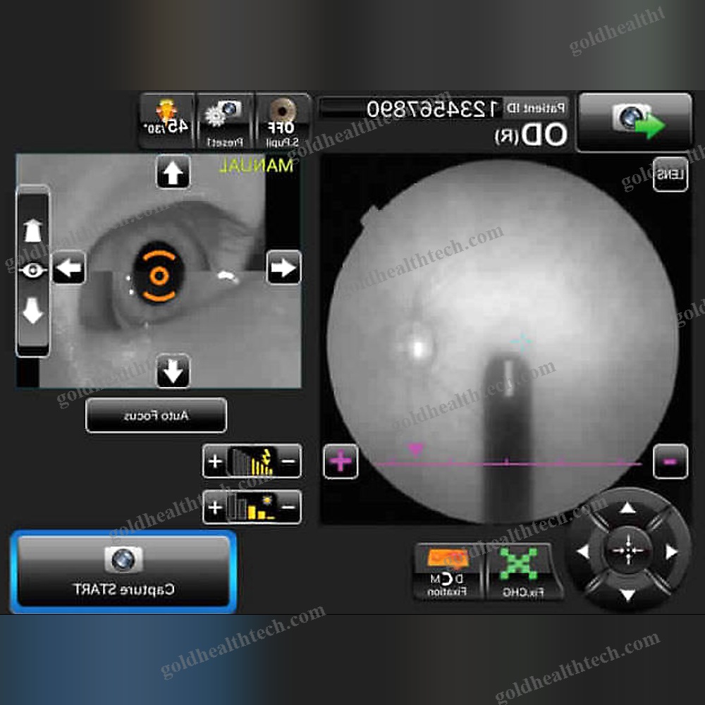 Non-Mydriatic Retinal Camera