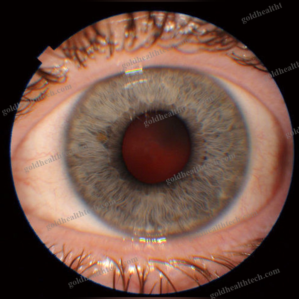 Non-Mydriatic Retinal Camera