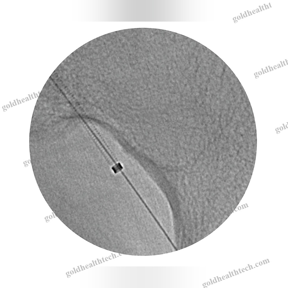 Femoral Access Sheath