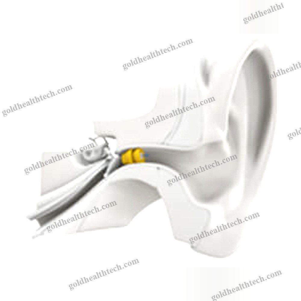Iic Hearing Aid
