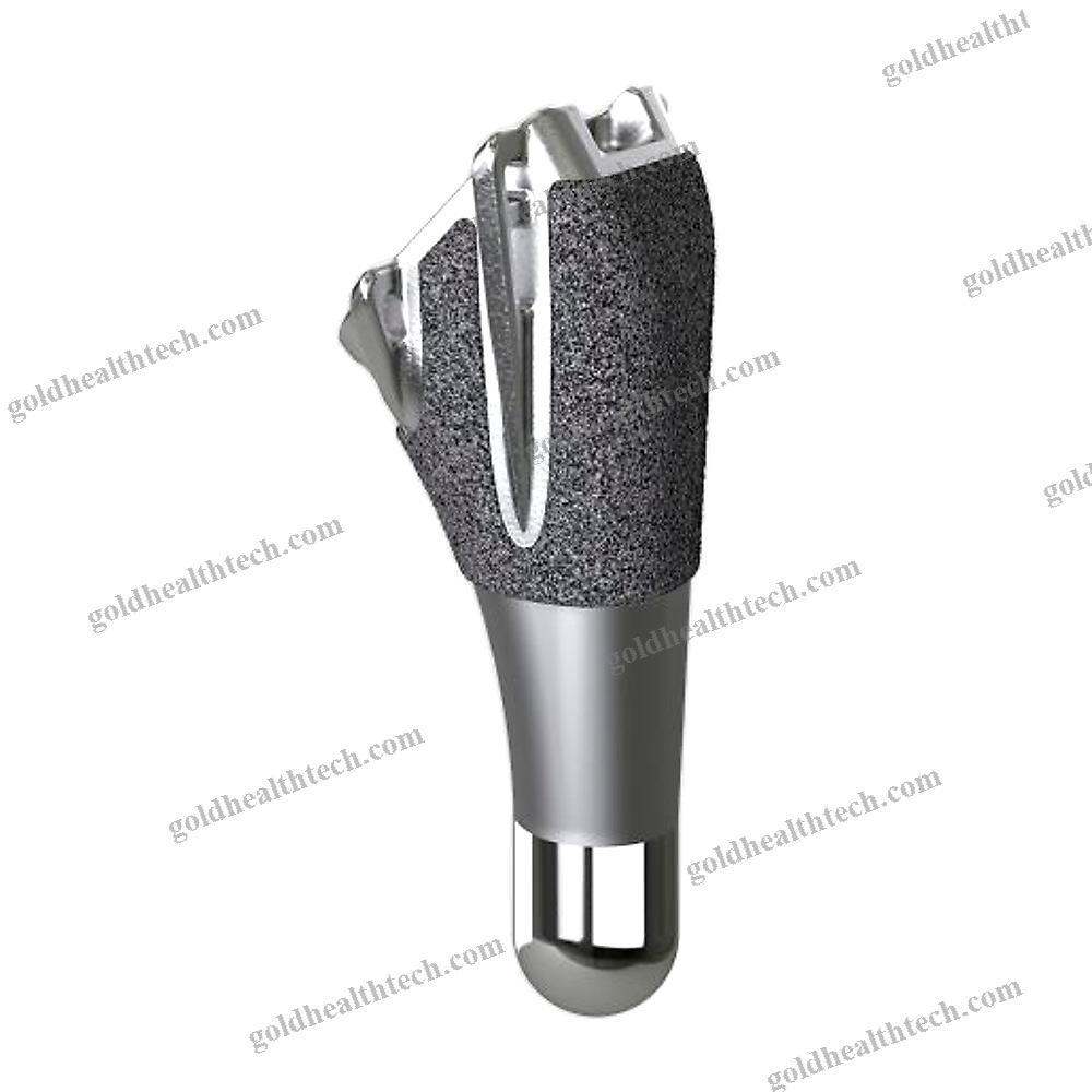 Cementless Shoulder Prosthesis