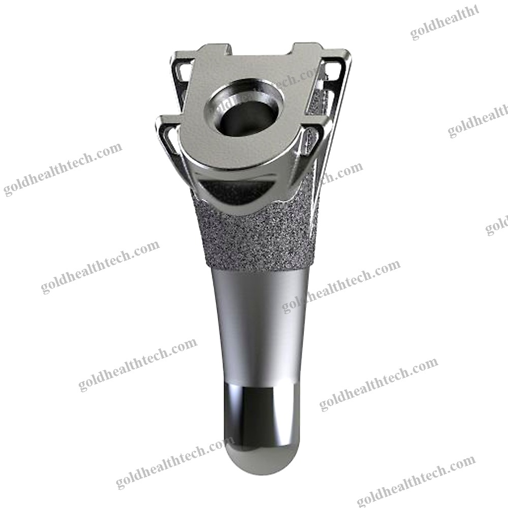 Cementless Shoulder Prosthesis