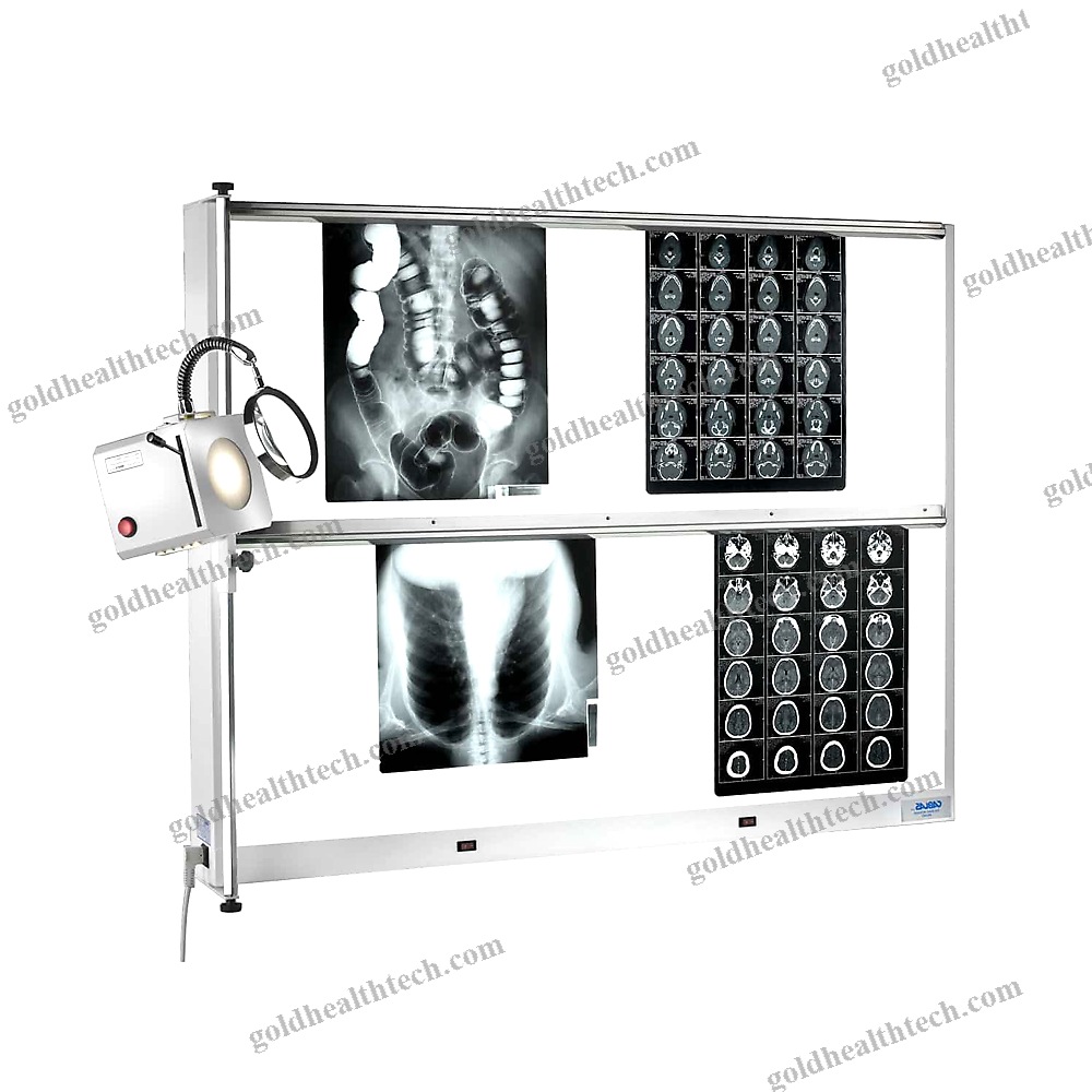 2-Screen X-Ray Film Viewer