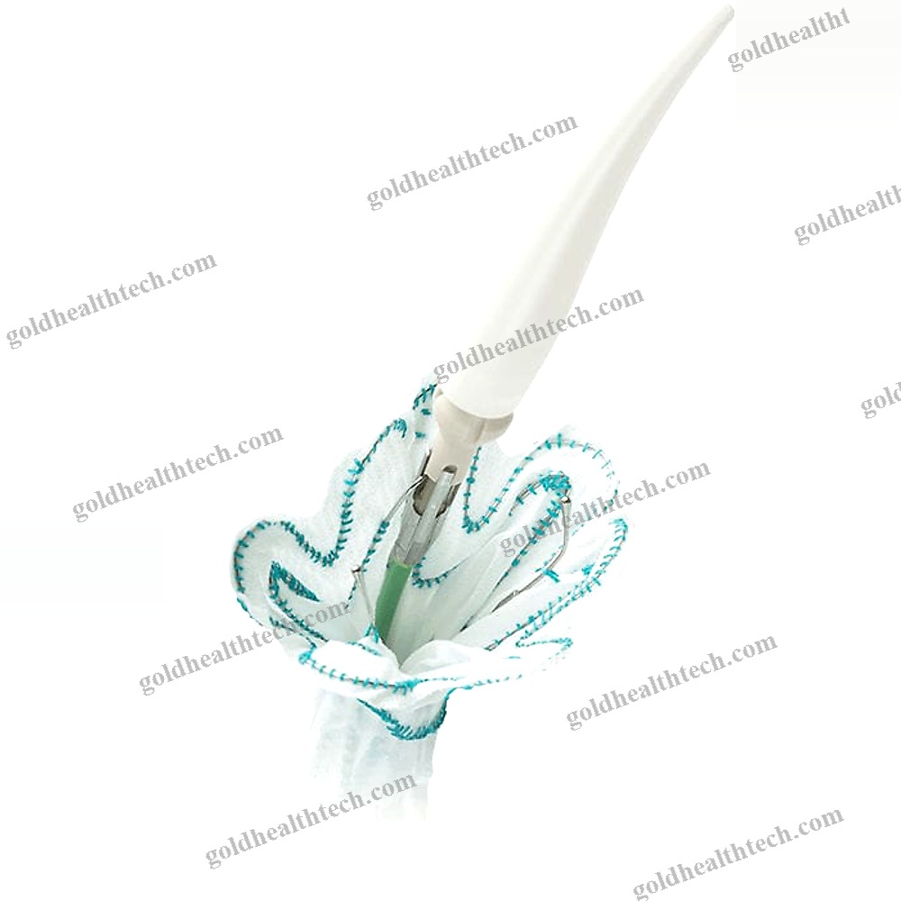 Ascending Thoracic Aorta Stent Graft