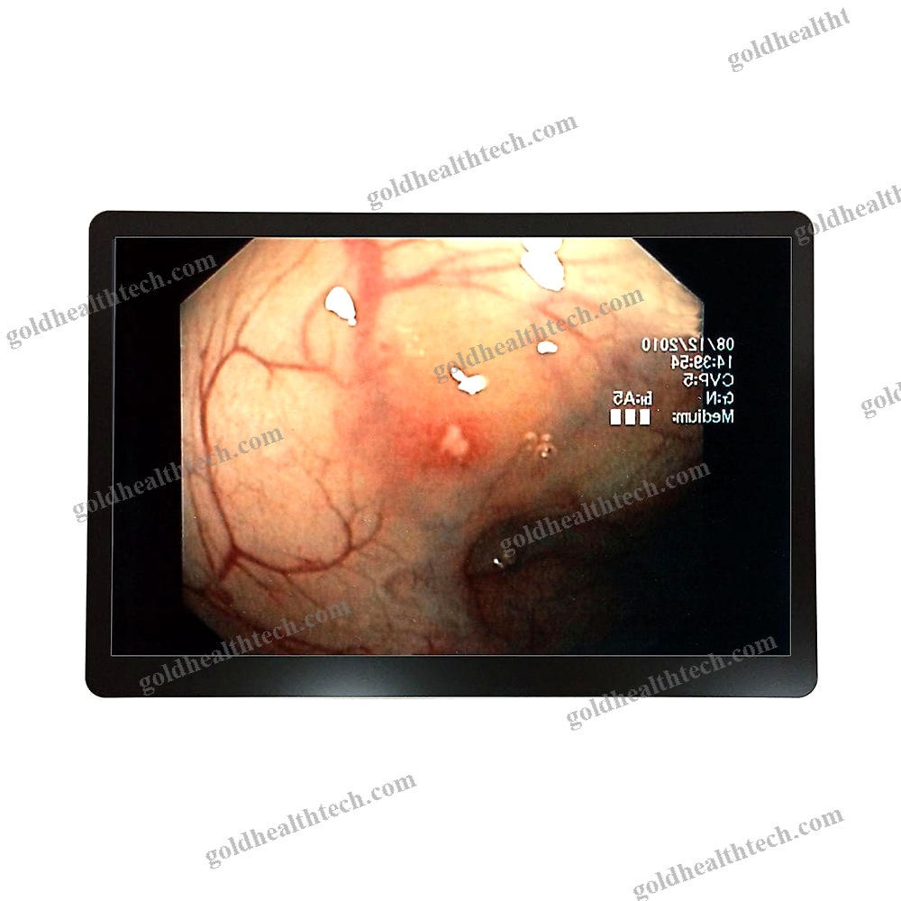 Ultrasound Imaging Display