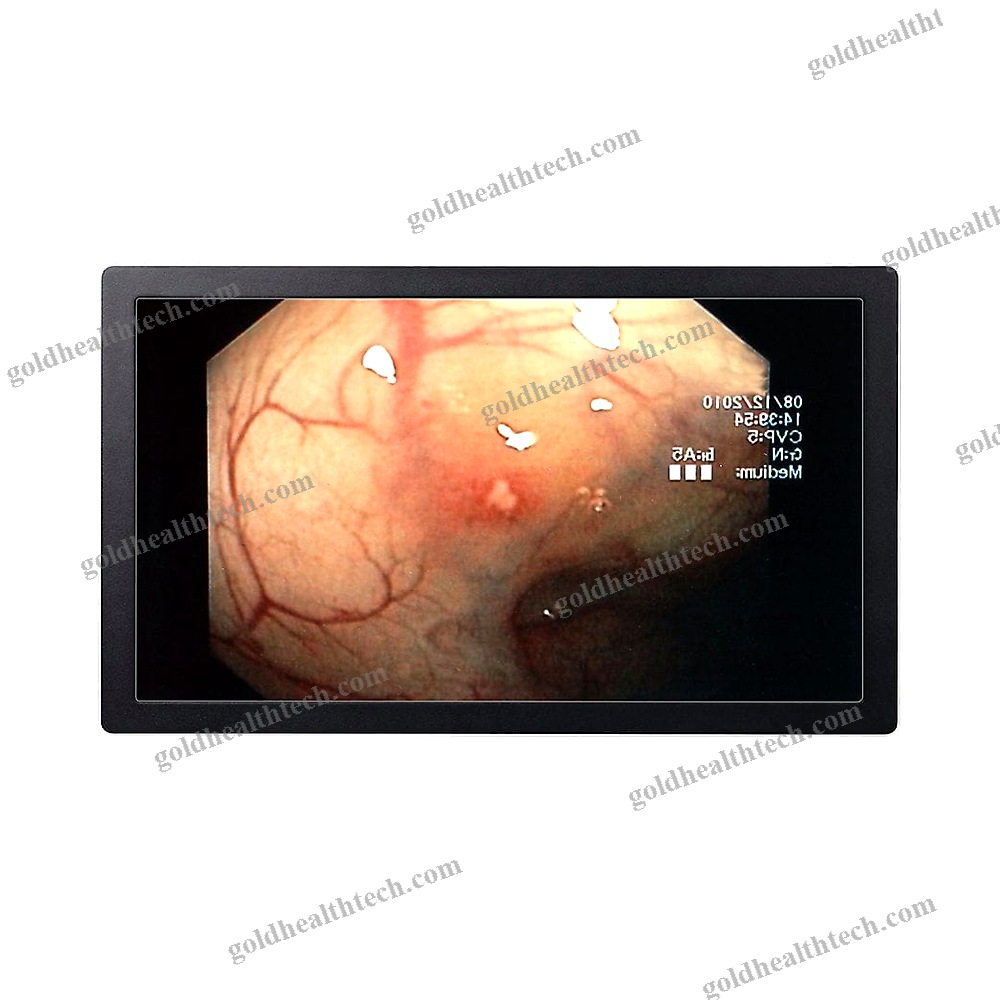 Endoscopy Display