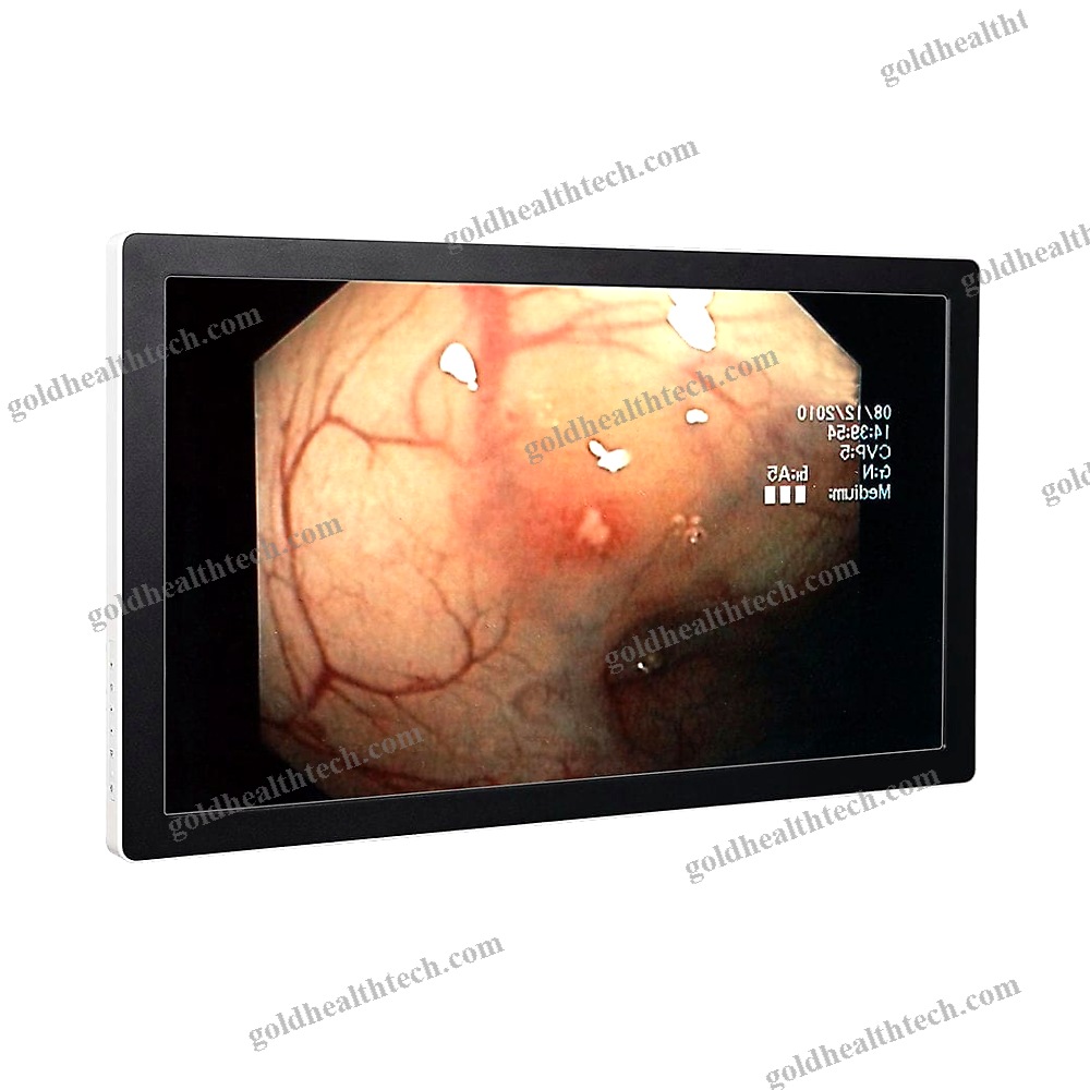 Endoscopy Display