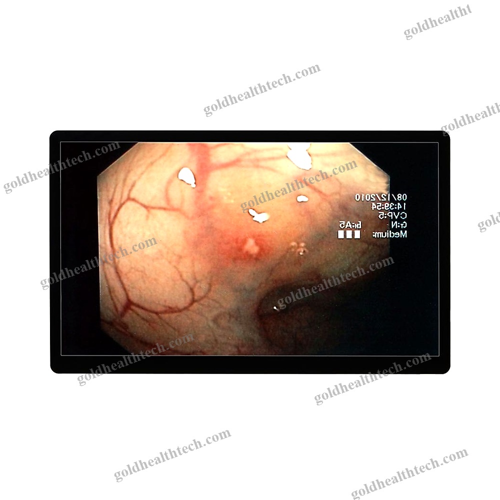 Endoscopy Display