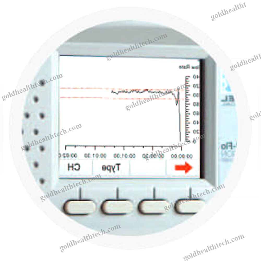 Infusion Pump Analyser