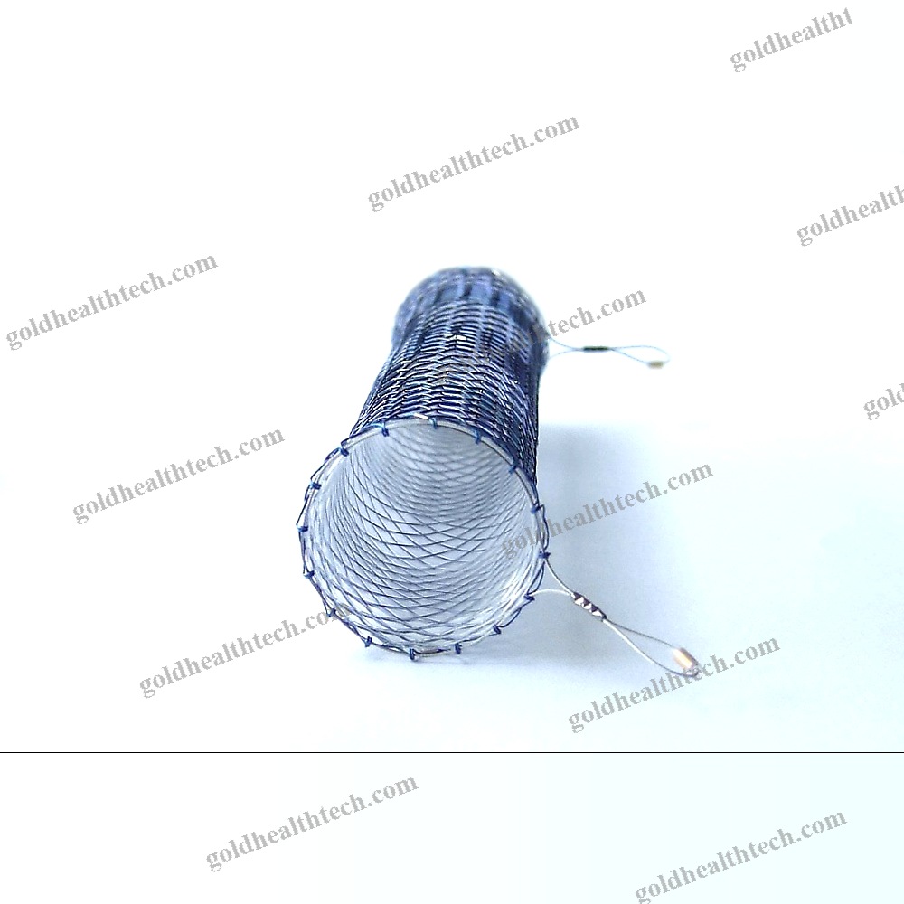 Esophageal Stent