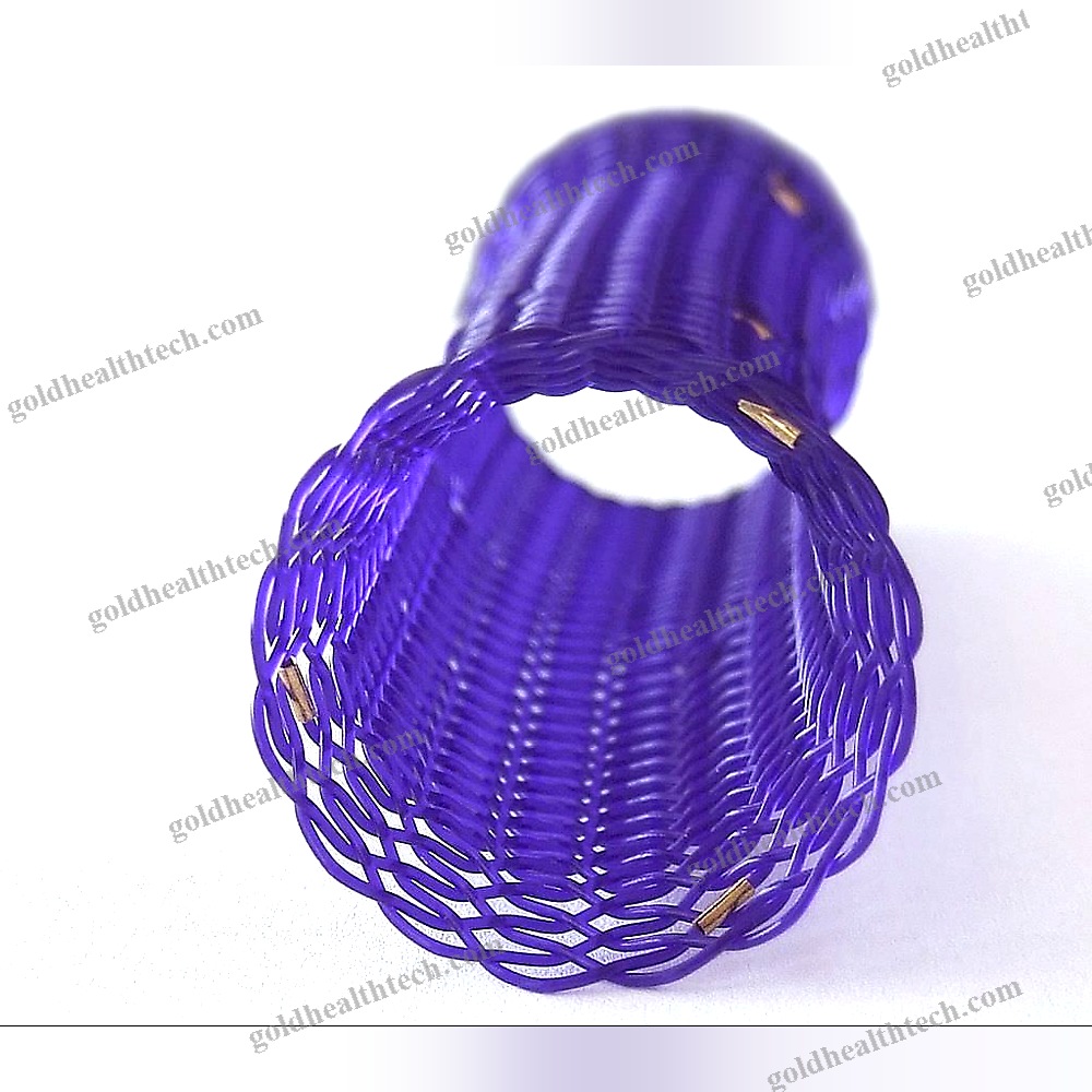 Esophageal Stent
