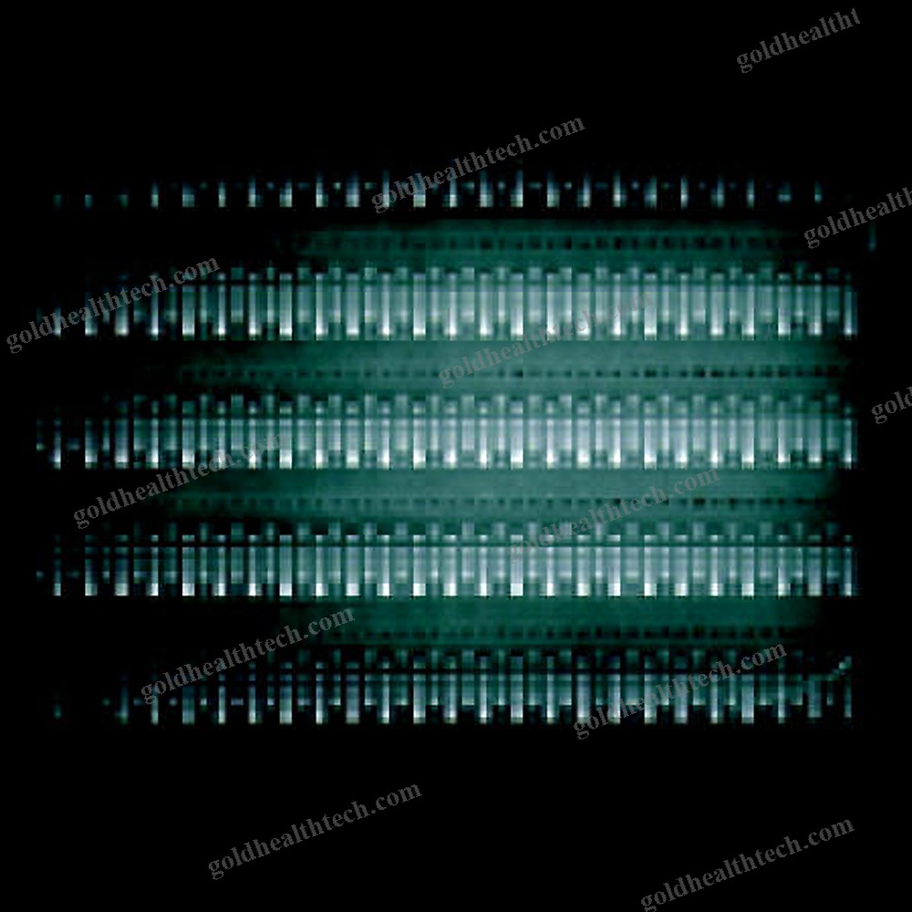 Horizontal Electrophoresis Chamber