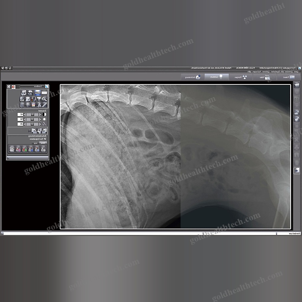 Medical Software