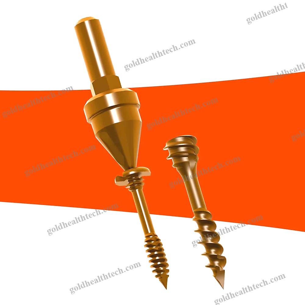 Forefoot Osteotomy Screw