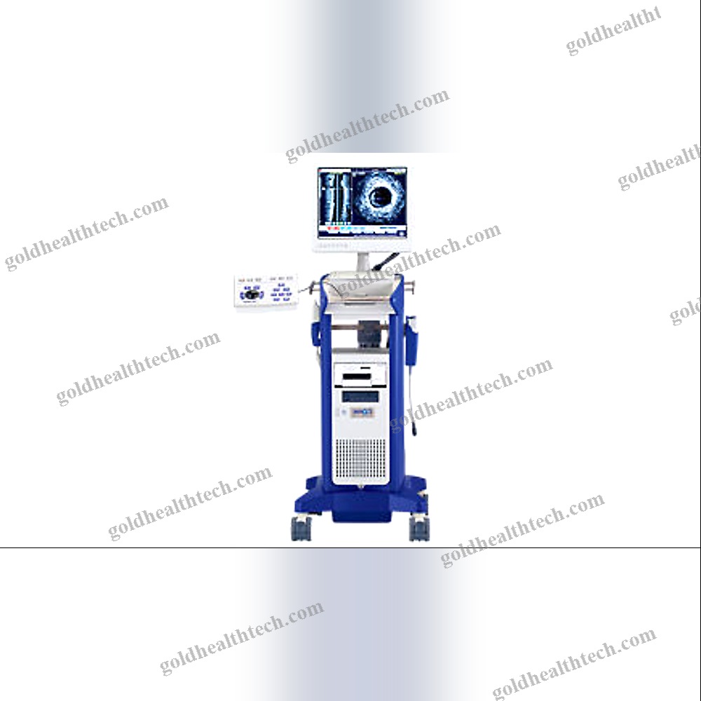 On-Platform Ultrasound System