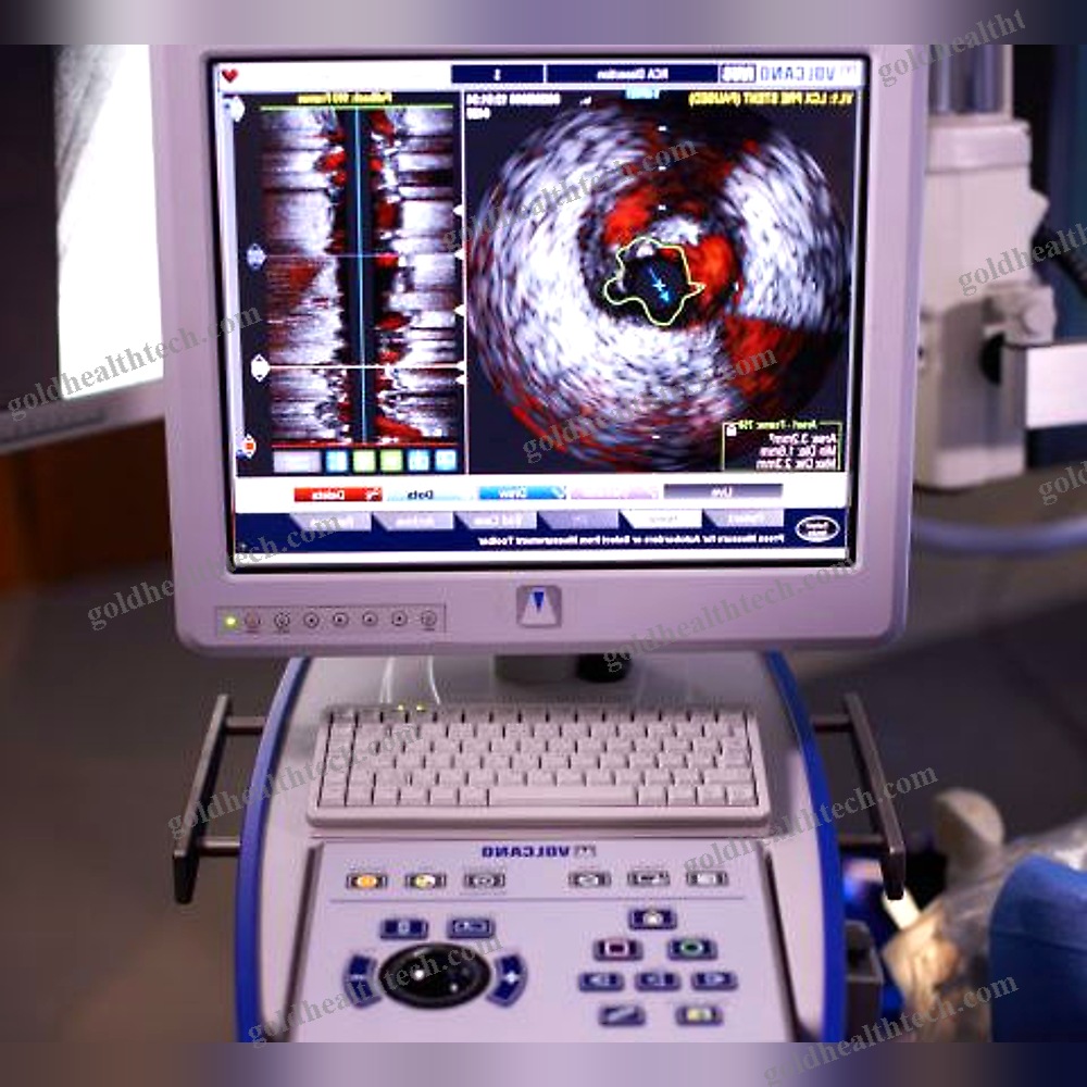 On-Platform Ultrasound System