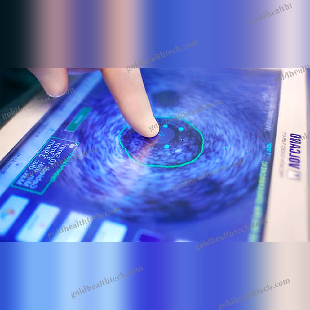 On-Platform Ultrasound System