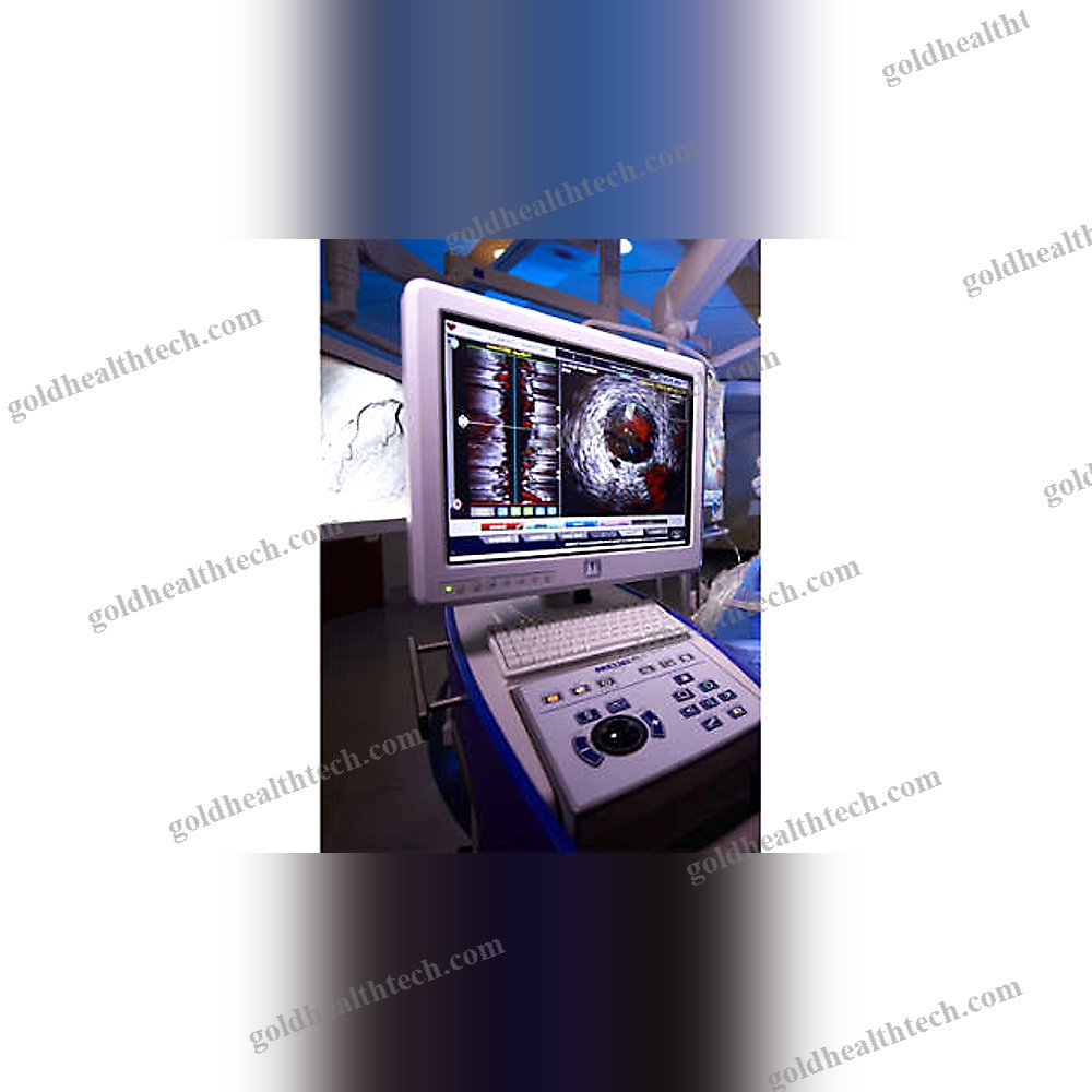 On-Platform Ultrasound System