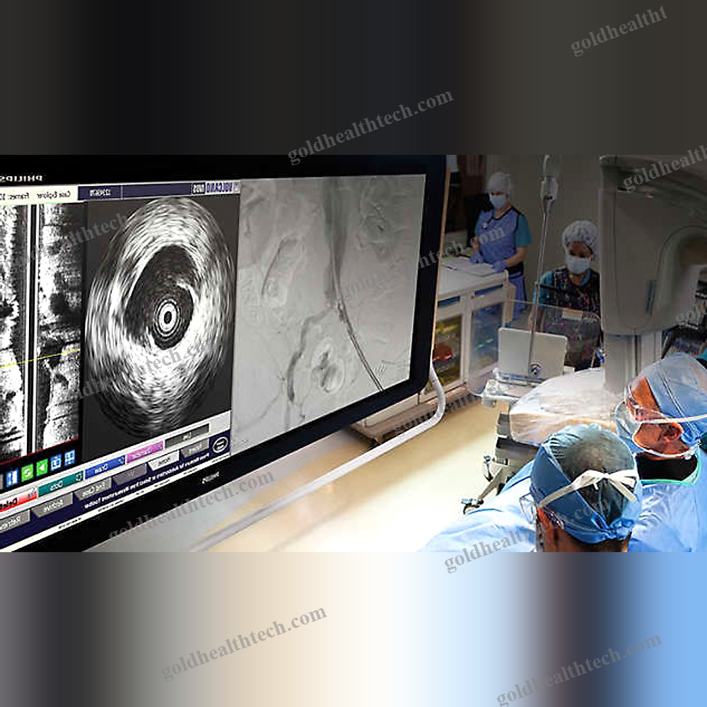 On-Platform Ultrasound System