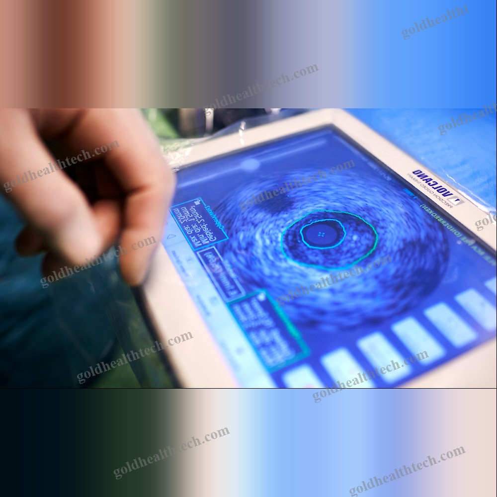 On-Platform Ultrasound System