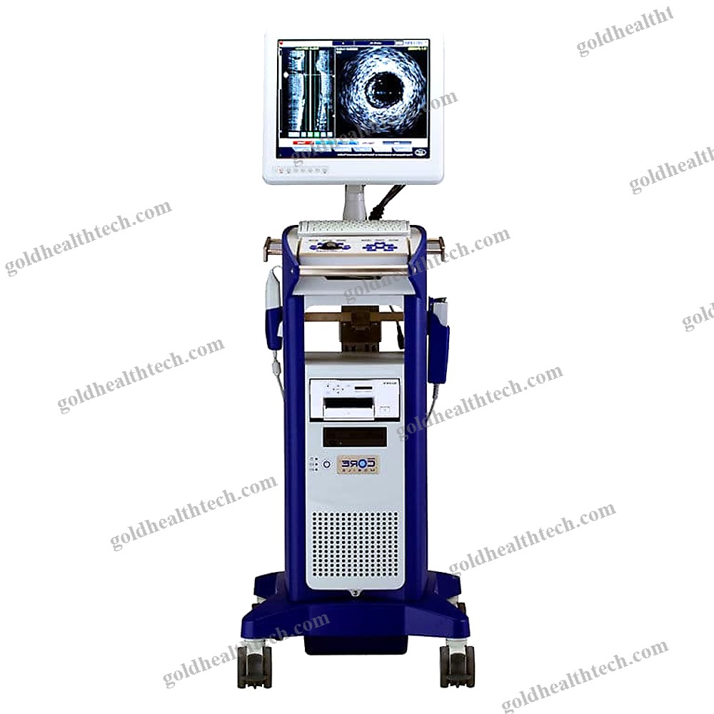 On-Platform Ultrasound System