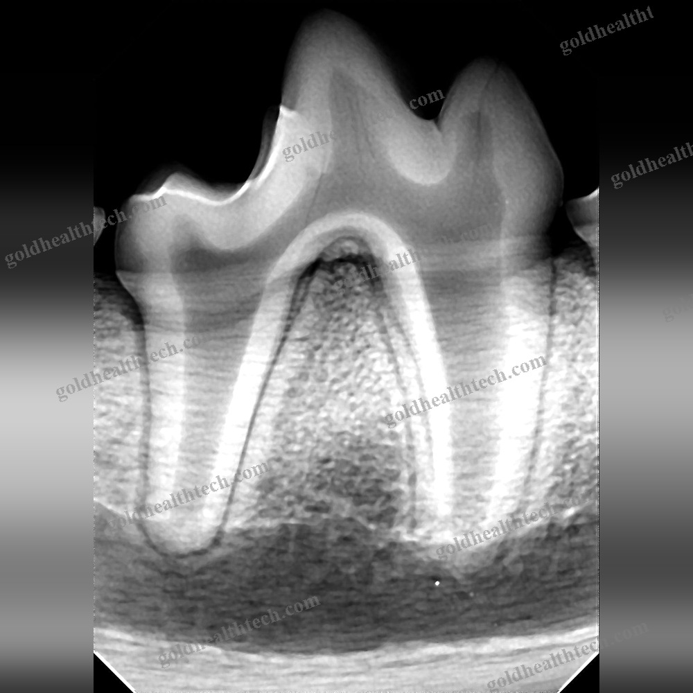 Veterinary Dental Imaging Software