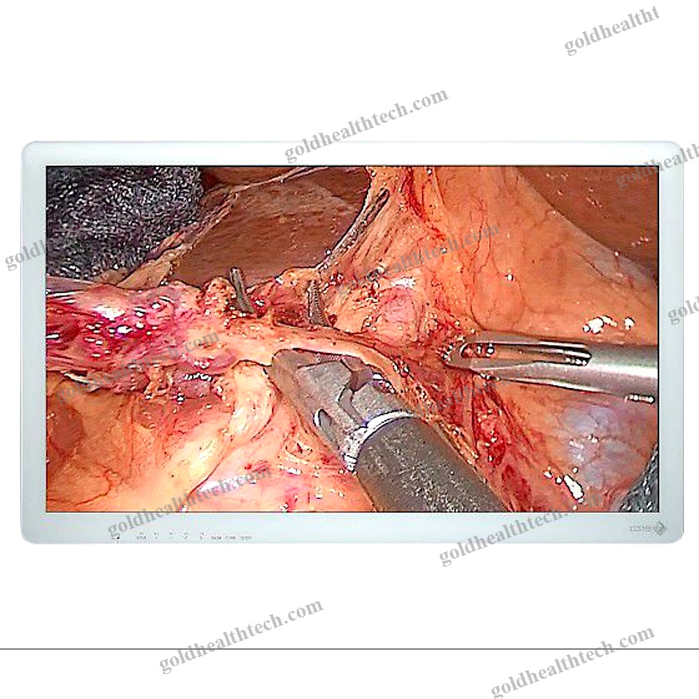 Surgical Display