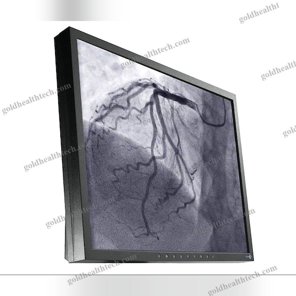 Or Display
