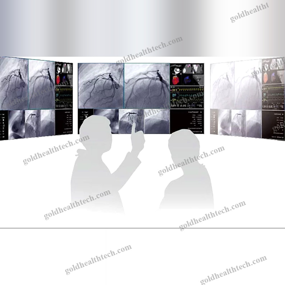 Or Display