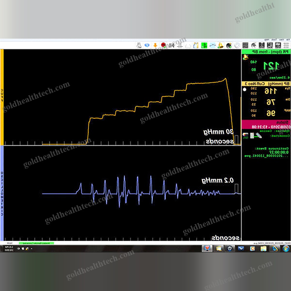 Automatic Blood Pressure Monitor