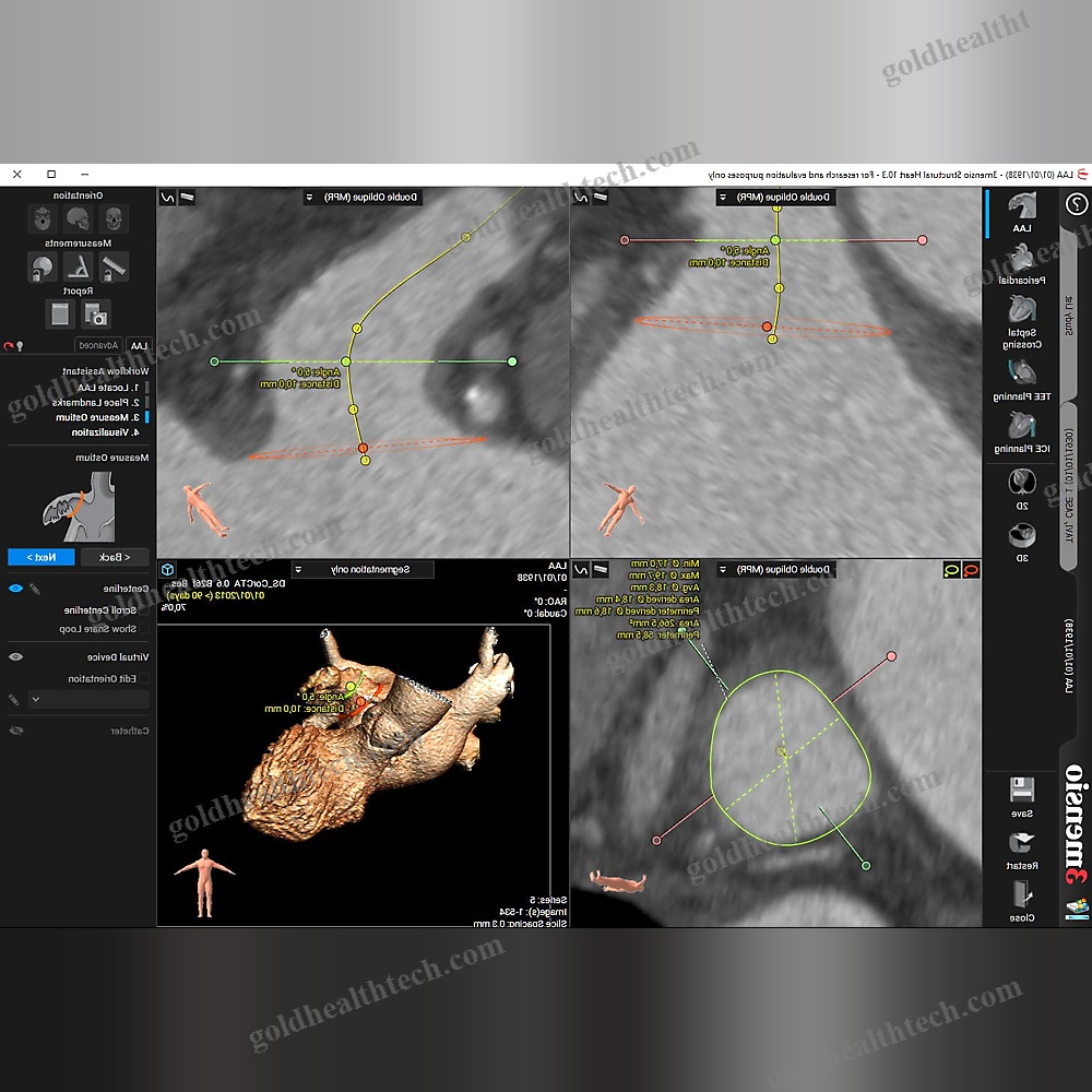 Medical Software Module