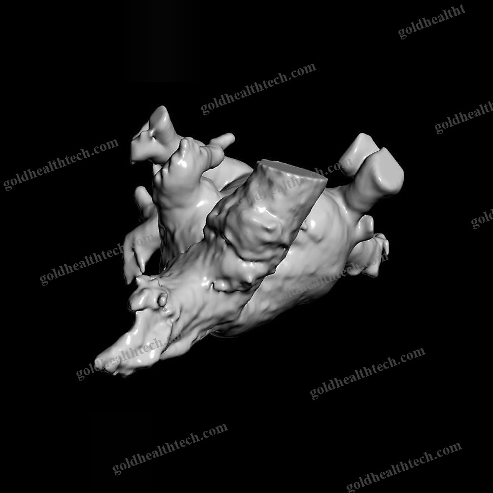 Ct Software