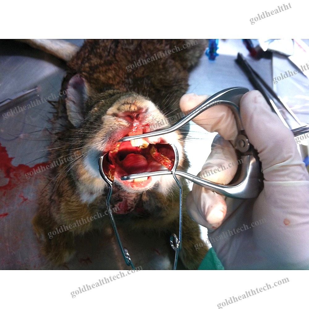 Dental Mouth Gag