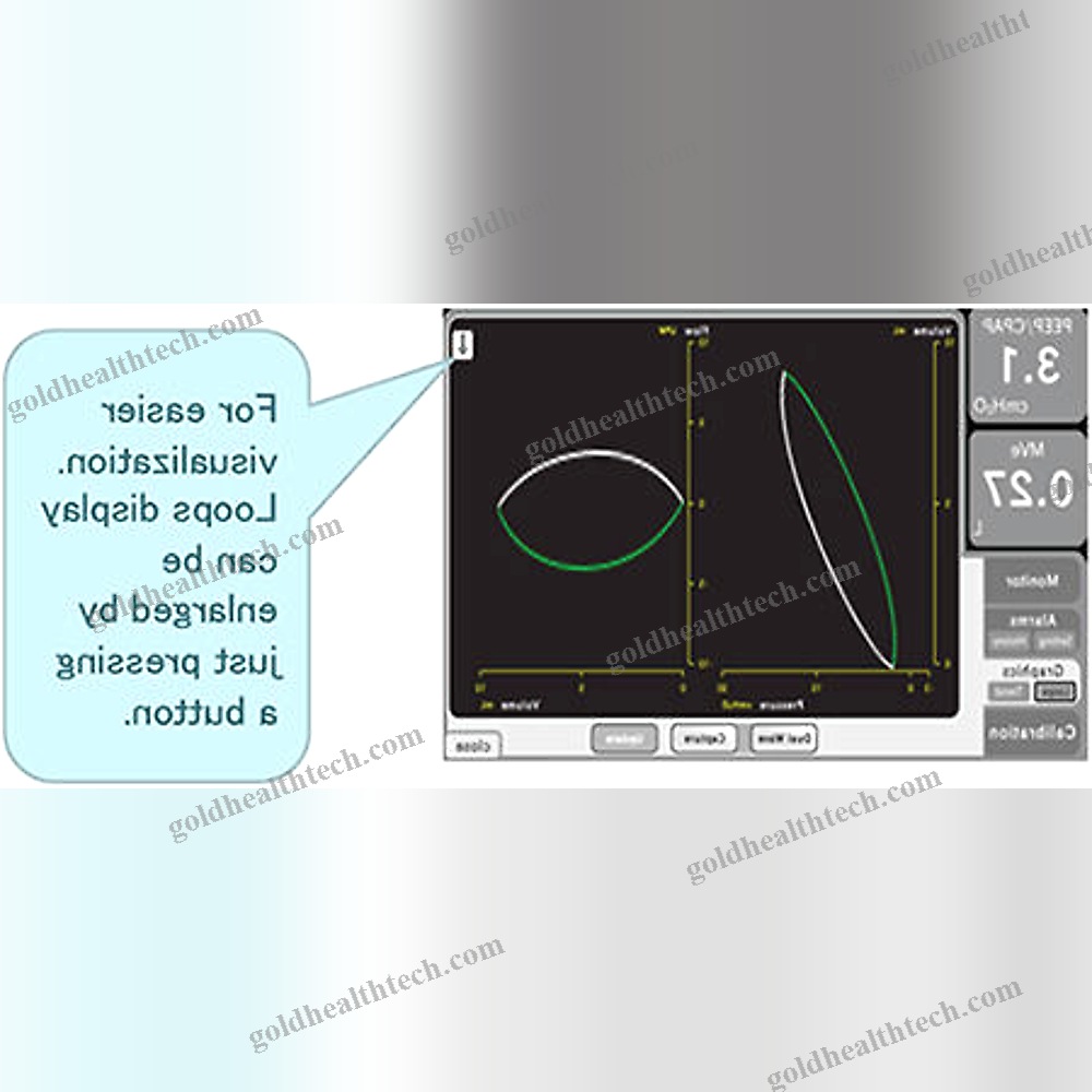 Resuscitation Ventilator