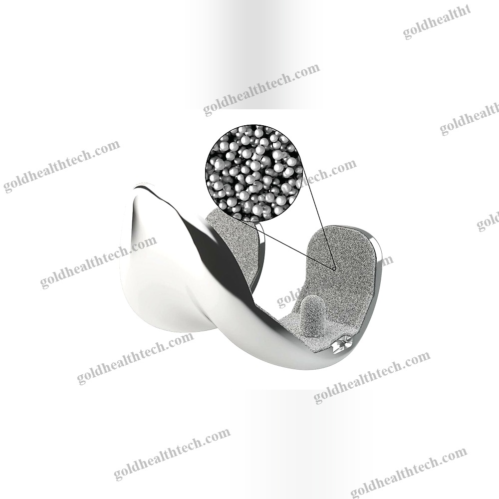 Total Knee Prosthesis