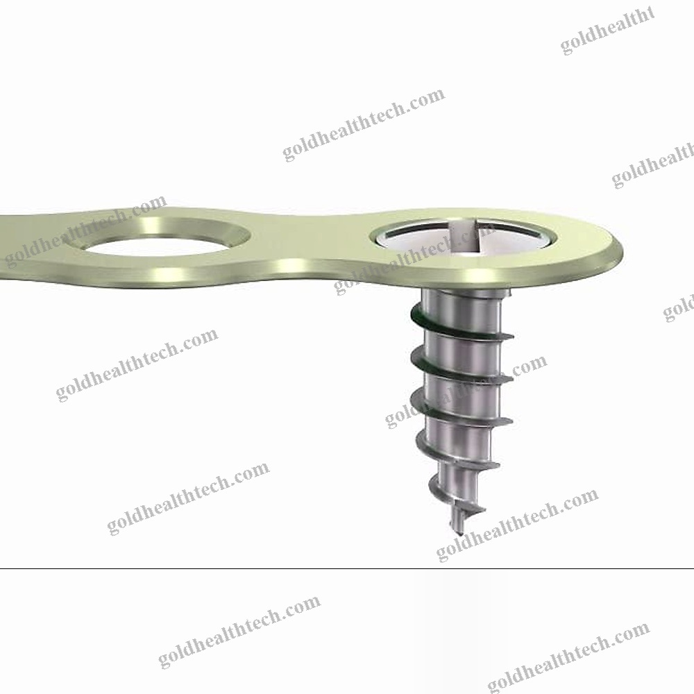 Non-Absorbable Cranial Fixation System