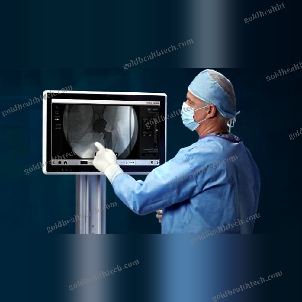 Orthopedic Surgery Surgical Navigation System