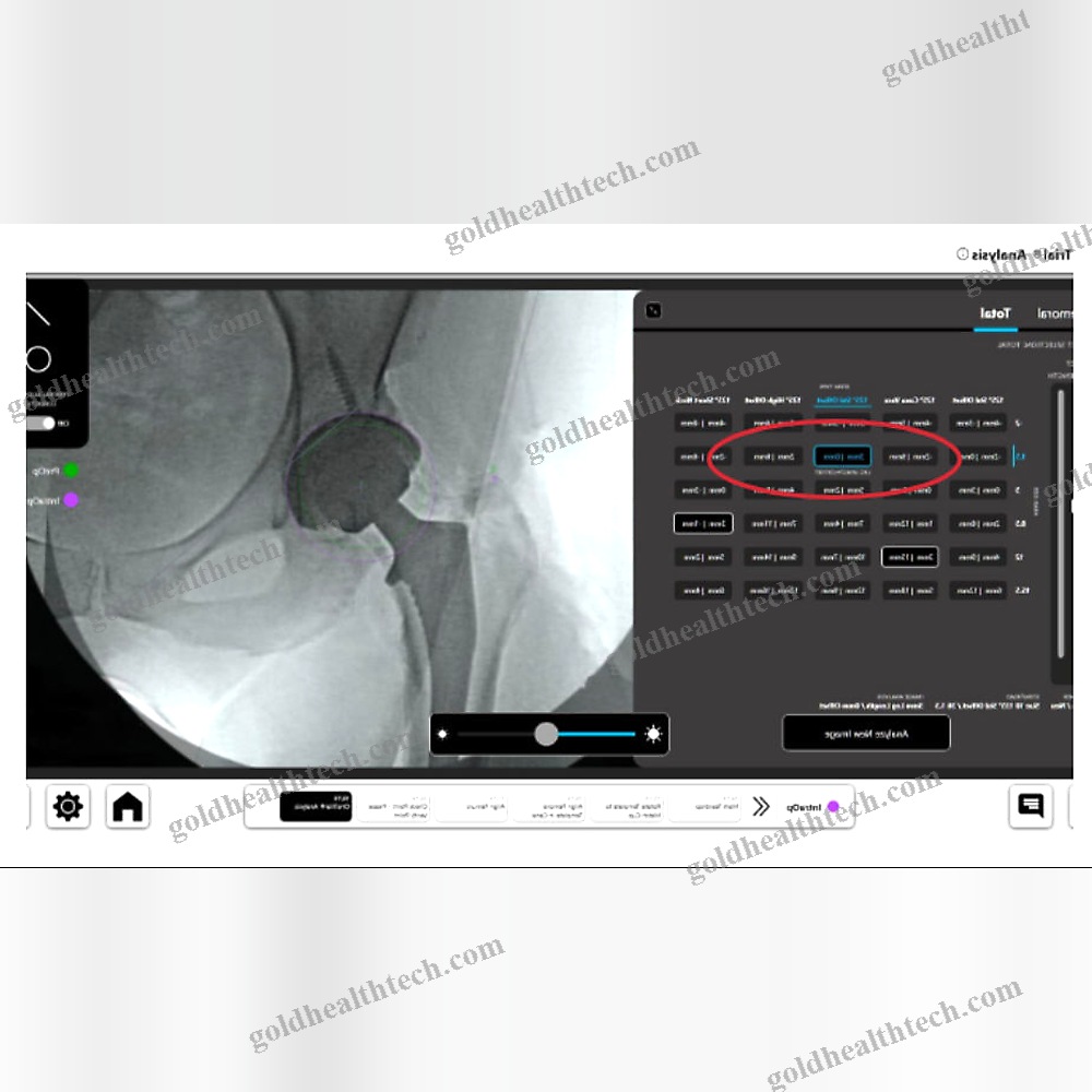 Orthopedic Surgery Surgical Navigation System