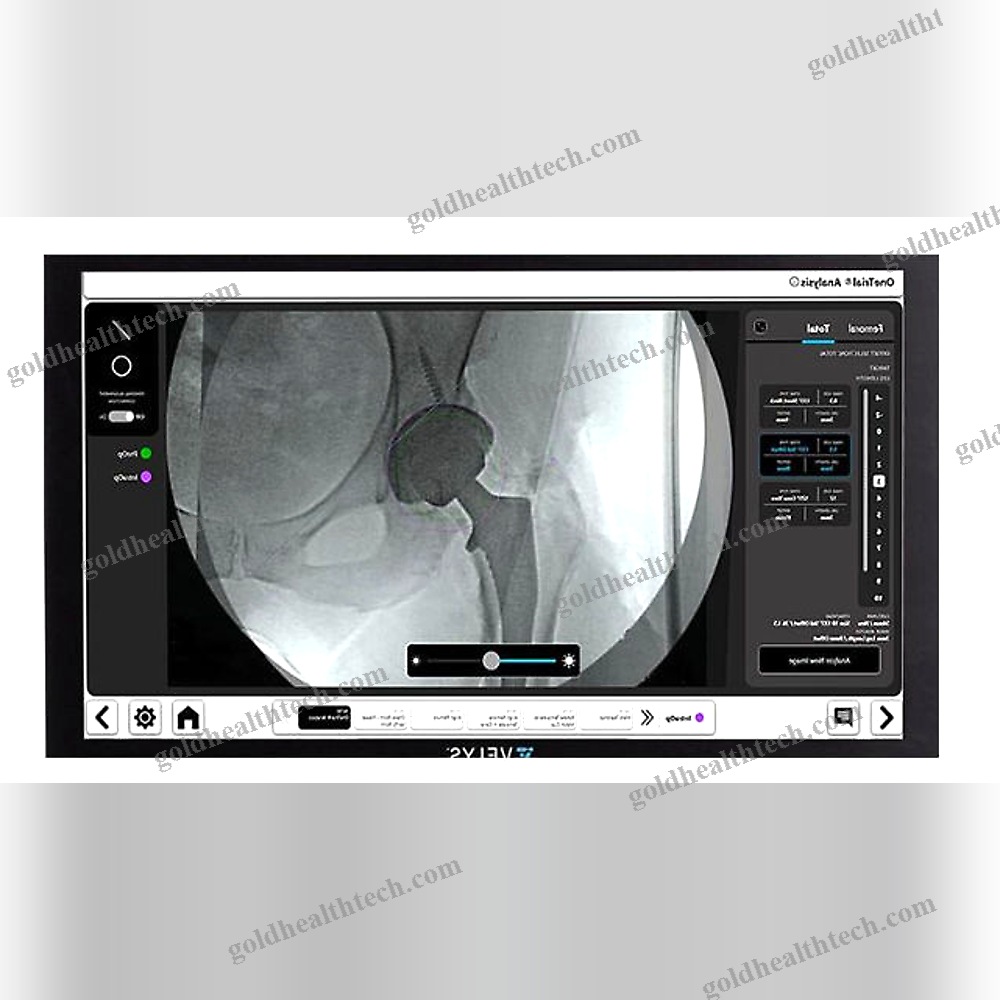 Orthopedic Surgery Surgical Navigation System